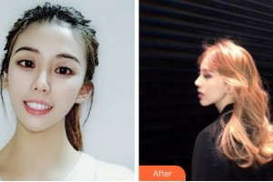 滁州市中西醫(yī)結(jié)合醫(yī)院眼科韓有田整形價格表附眼部整形案例展示