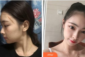 阜陽東方美萊塢醫(yī)療美容醫(yī)院勇中華整形價格表附祛疤案例展示