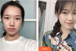 阜陽王小妹醫(yī)學(xué)美容整形門診部王小妹整形價格表附祛疤案例展示