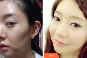 阜陽東方美萊塢醫(yī)療美容醫(yī)院趙士俊整形價格表附抗衰案例展示