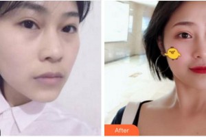 阜陽七院愛爾眼科醫(yī)院尚力強整形價格表附面部抗衰案例展示