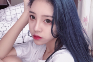 長(zhǎng)沙湘江愛(ài)爾眼科醫(yī)院王啟常整形價(jià)格表附切開(kāi)雙眼皮案例展示