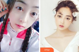 阜陽福田眼科醫(yī)院王東偉整形價格表附眼部綜合案例展示