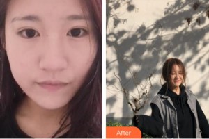 宿州漢密爾頓醫(yī)學(xué)美容醫(yī)院張躍偉整形價格表附嫩膚案例展示