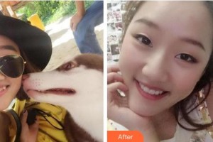 六安竹子口腔醫(yī)院王憲順整形價格表附牙齒隱形矯正案例展示