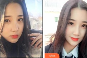 六安艾雯口腔門診劉瑜整形價格表附冷光美白案例展示