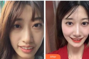 亳州郭琳口腔診所周秀琴整形價格表附牙齒美白案例展示