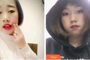 亳州嚴(yán)秀口腔診所趙冰川整形價格表附牙綜合案例展示