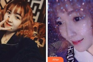 亳州嚴(yán)秀口腔診所王傲杰整形價格表附超聲波潔牙案例展示