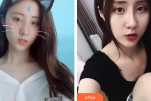 池州佳美皮膚美容醫(yī)院孟憲兵整形價(jià)格表附激光祛斑案例展示