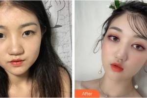 宣城康視五官科醫(yī)院眼科劉碧泉整形價格表附眼部綜合案例展示