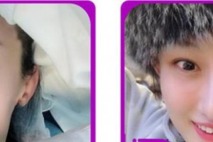 浙江大學(xué)醫(yī)學(xué)院附屬口腔醫(yī)院胡軍整形價格表附冷光美白案例展示