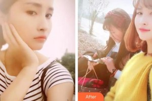 浙江大學(xué)醫(yī)學(xué)院附屬口腔醫(yī)院蔡霞整形價格表附美白貼片案例展示