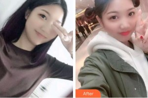 浙江大學(xué)醫(yī)學(xué)院附屬口腔醫(yī)院陳民棟整形價格表附牙齒根管調(diào)節(jié)案例展示