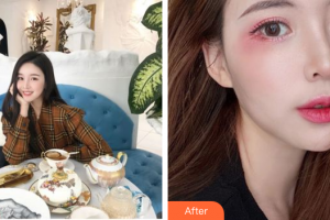 廣州博仕整形美容醫(yī)院高吉整形價(jià)格表附芭比雙眼術(shù)案例展示