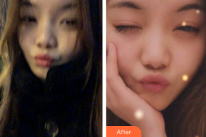 廣州圣貝口腔門診部蔡菁菁整形價(jià)格表附時(shí)代天使矯正案例展示