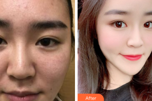 廣州圣諾達(dá)醫(yī)療美容門診部曹珂整形價(jià)格表附抗衰產(chǎn)品案例展示