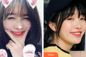 廣州穗華口腔醫(yī)院謝曉聰整形價(jià)格表附牙齒美白案例展示