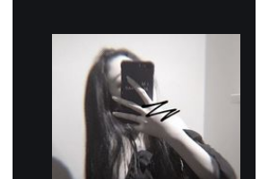 衡陽雅美醫(yī)療美容醫(yī)院袁妍妍整形價格表附玻尿酸精華導入案例展示