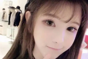 衡陽(yáng)雅美醫(yī)療美容醫(yī)院王曉朋整形價(jià)格表附鐳射凈膚案例展示