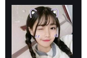 衡陽(yáng)愛(ài)爾眼科醫(yī)院劉心紅整形價(jià)格表附切開(kāi)雙眼皮案例展示