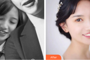 廣州愛康健口腔門診部郭俊偉整形價(jià)格表附金屬托槽矯正案例展示