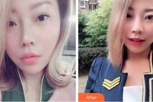 杭州華山連天美醫(yī)療美容整形醫(yī)院吳國(guó)興整形價(jià)格表附牙齒隱形矯正案例展示