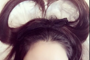 衡陽(yáng)愛(ài)爾眼科醫(yī)院羅君整形價(jià)格表附眼部綜合案例展示