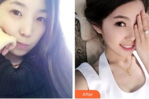 杭州香格里拉醫(yī)療美容醫(yī)院徐啟飛整形價格表附牙齒隱形矯正案例展示