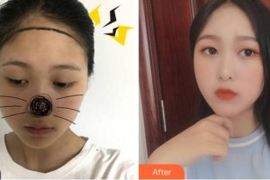 杭州新生毛發(fā)種植研究院王利軍整形價格表附種植發(fā)際線案例展示