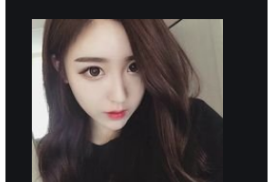 岳陽(yáng)愛(ài)思特醫(yī)療美容醫(yī)院薛紅宇整形價(jià)格表附自體脂肪填充額頭案例展示