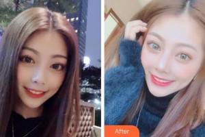 杭州愛琴海醫(yī)療美容醫(yī)院方剛整形價(jià)格表附冷光美白案例展示