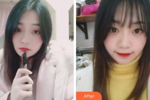 杭州華山連天美醫(yī)療美容整形醫(yī)院姜鑫利整形價(jià)格表附牙齒隱形矯正案例展示