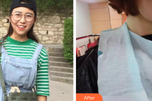 廣州市荔灣區(qū)口腔醫(yī)院蔣潔整形價(jià)格表附牙齒矯正案例展示