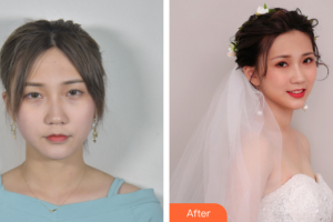 廣州聯(lián)合麗格醫(yī)療美容門診部葉海洲整形價(jià)格表附眼部綜合案例展示