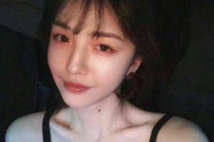 岳陽(yáng)愛(ài)思特醫(yī)療美容醫(yī)院楊國(guó)正整形價(jià)格表附清潔祛痘案例展示