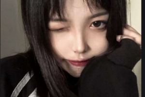 常德燒傷整形醫(yī)院陳志勇整形價(jià)格表附自體脂肪全臉填充案例展示