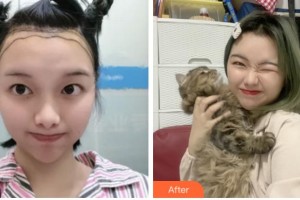 杭州雍禾植發(fā)醫(yī)院周剛整形價(jià)格表附種植發(fā)際線案例展示