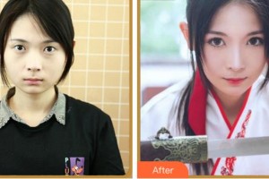 杭州朝聚眼科醫(yī)院張鑫整形價(jià)格表附眼部綜合案例展示