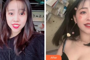 杭州美奧口腔門診部紀(jì)鳳賀整形價(jià)格表附金屬托槽矯正案例展示