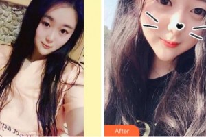 義烏杭州口腔門診部駱英整形價(jià)格表附美白劑美白牙齒案例展示