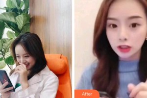 杭州品凱口腔醫(yī)院韓睿整形價(jià)格表超聲波潔牙案例展示