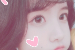 常德口腔醫(yī)院倪星原整形價格表附牙貼面案例展示