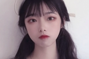 益陽(yáng)德美整形醫(yī)院周超整形價(jià)格表附金屬托槽矯正案例展示