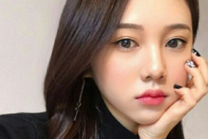 益陽(yáng)市中心醫(yī)院美容整形科劉安久整形價(jià)格表附玻尿酸墊下巴案例展示