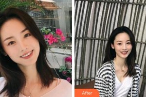 杭州品凱口腔醫(yī)院高春林整形價(jià)格表附牙綜合案例展示