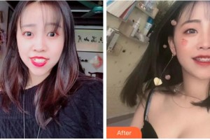 杭州博凡口腔門診部賈旭整形價(jià)格表附金屬托槽矯正案例展示