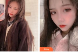 杭州愛爾眼科醫(yī)院沈曄整形價(jià)格表附眼部綜合案例展示