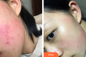 深圳同仁醫(yī)療美容醫(yī)院姜昱瑾整形價格表附皮膚管理案例展示