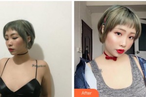 寧波同仁婦科醫(yī)院整形美容科胡繼來整形價格表附自體脂肪隆胸案例展示